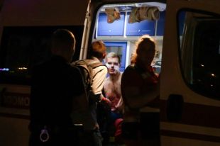 «Тусовка» с поножовщиной»: в центре Киева парню порезали лицо ножом