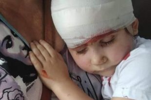 Мужчина на детской площадке зацепил девочку качелями: ребенок в реанимации