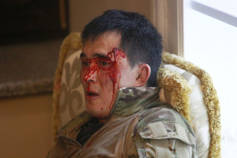 Пострадавший боец спецназа в результате спецоперации по задержанию экс-президента Киргизии Алмазбека Атамбаева.