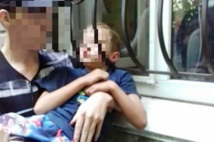В Кривом Роге ребенок застрял головой в оконной решетке