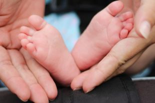 Чудо: в Черновцах женщина родила сиамских близнецов