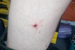 В Николаеве женщина стреляла по сотрудникам банка: есть пострадавшие