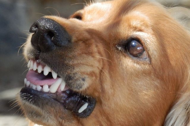 В Боровском собака напала на подростка и прокусила ему ногу