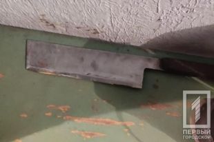В Кривом Роге мужчине отрезали палец из-за громкого разговора по телефону