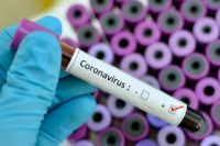 В Украину прибыли тест-системы для обнаружения нового вида коронавируса