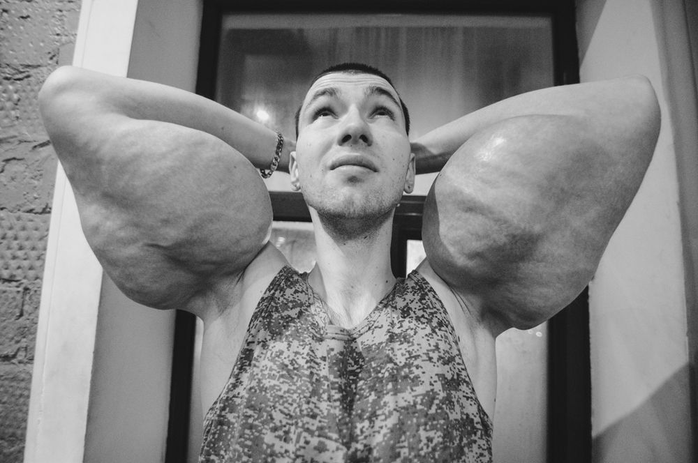 Снимок фотографа Антона Доценко из США. На фото — Кирилл Терешин, получивший прозвище «руки-базуки» из-за инъекций, которые он делал, чтобы получить рельефную мускулатуру. Таким образом, фотограф хотел рассказать об опасности таких методов.