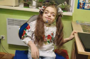 Алиса ждет чудес: девятилетняя девочка нуждается в нашей помощи