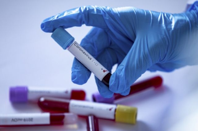 В Украине подтвердили еще два случая заражения коронавирусом