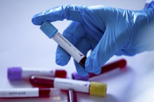 За границей от коронавируса лечатся 12 украинцев