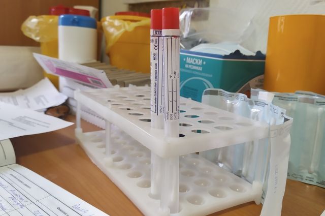 В Житомире зафиксирован случай заражения коронавирусом: подробности
