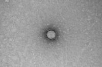 Ученые увеличили опасный вирус под микроскопом и сфотографировали его.