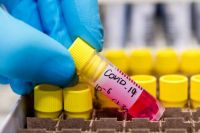 В Украине зафиксировано 84 случая заболевания COVID-19
