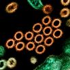 H1N1 («свиной грипп»). В апреле-мае 2009 года вспышка нового штамма вируса гриппа наблюдалась в Мексике и США. 11 июня ВОЗ объявила о пандемии свиного гриппа, первой пандемии за последние 40 лет. Было зарегистрировано около 255716 случаев инфицирования гриппом A/H1N1 и 2627 смертей в более чем 140 регионах мира. 