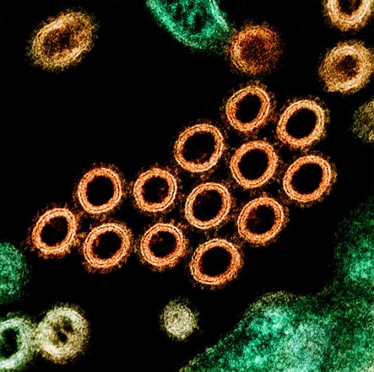 H1N1 («свиной грипп»). В апреле-мае 2009 года вспышка нового штамма вируса гриппа наблюдалась в Мексике и США. 11 июня ВОЗ объявила о пандемии свиного гриппа, первой пандемии за последние 40 лет. Было зарегистрировано около 255716 случаев инфицирования гриппом A/H1N1 и 2627 смертей в более чем 140 регионах мира. 