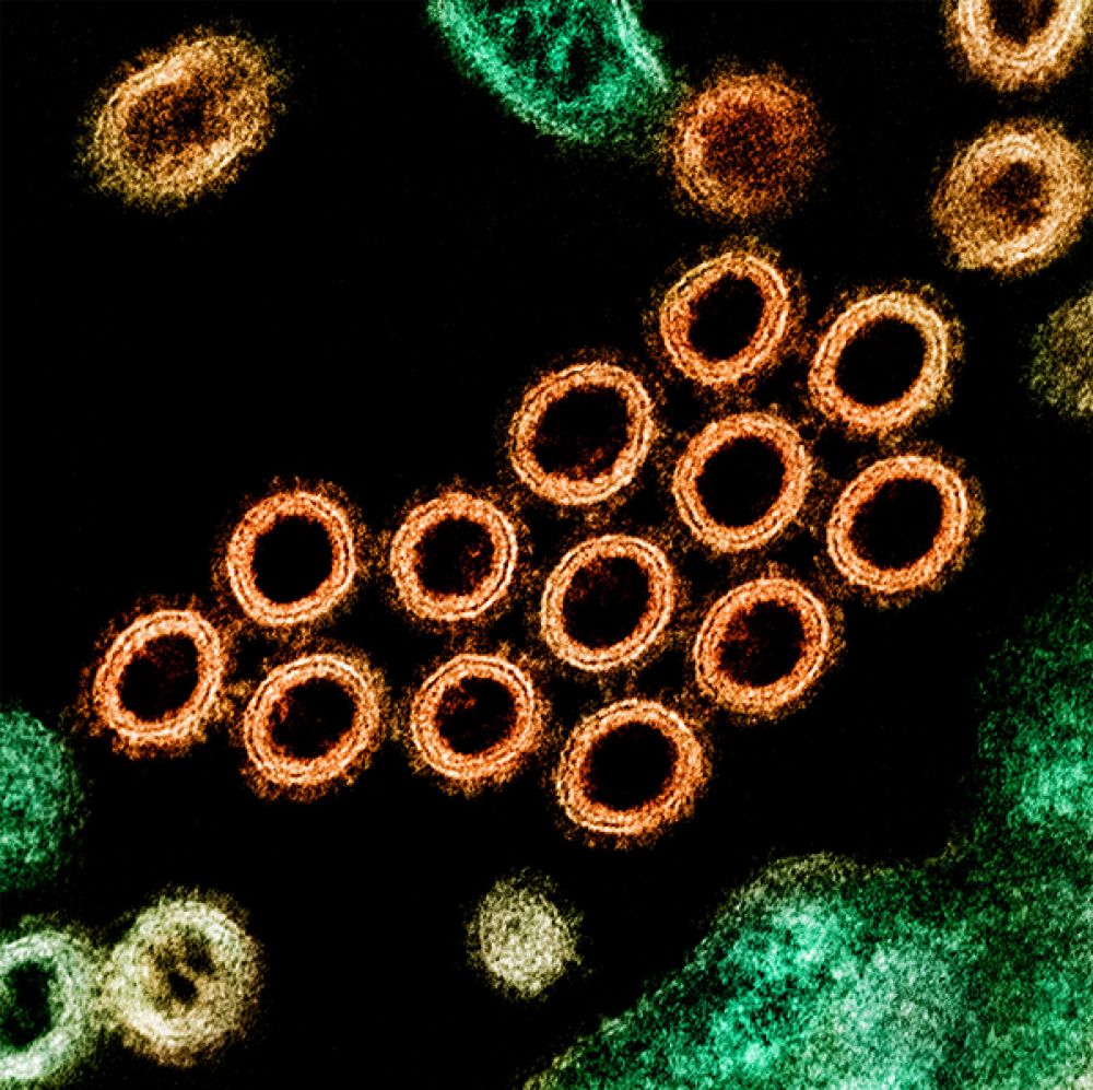Как Выглядят Вирусы Под Микроскопом Фото