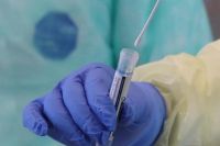 По данным на 9 апреля в Иркутской области госпитализировано 19 заражённых коронавирусной инфекцией. 