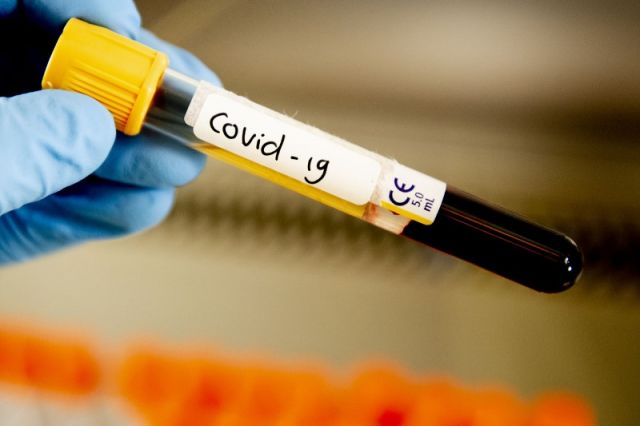 Врачи получили положительный тест на COVID-19.