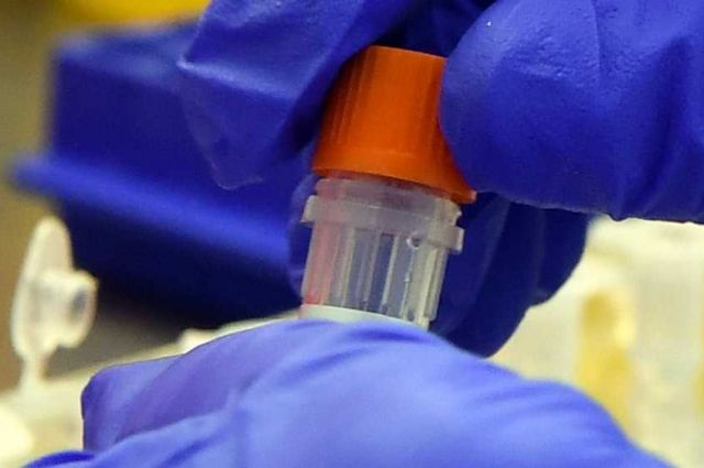 В ЯНАО диагностировали 36 новых случаев коронавируса