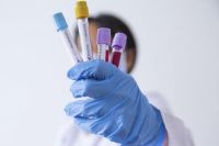 Минздрав планирует увеличить ПЦР-тестирований на коронавирус