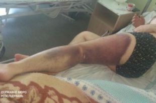 В Николаевской области полицейские избили подозреваемого