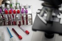 На Ямале за сутки диагностировали 51 новый случай коронавируса