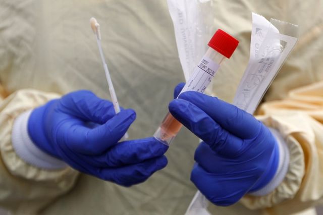 Новосибирских медиков тестируют на антитела к коронавирусу