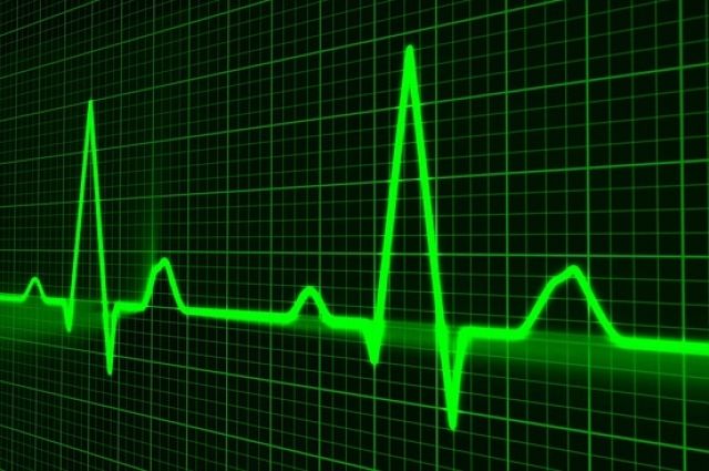 Тюменские врачи спасли пациента, у которого повторился инфаркт миокарда