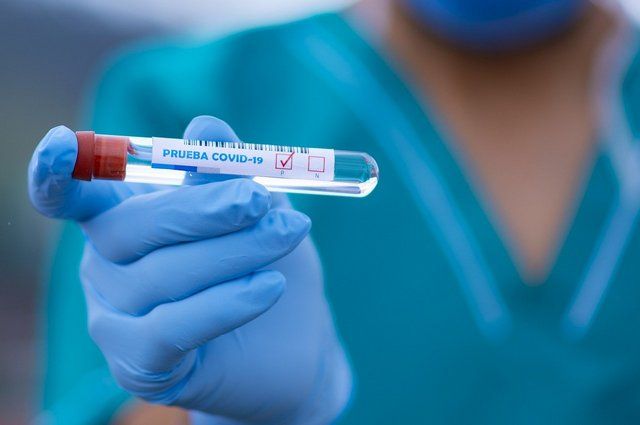 В Орловской области ещё у 86 человек нашли коронавирус