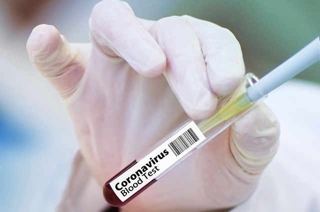 Еще один пациент с коронавирусом умер в Удмуртии