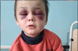 В Винницкой области мачехе, избивавшей пасынка, присудили два года тюрьмы