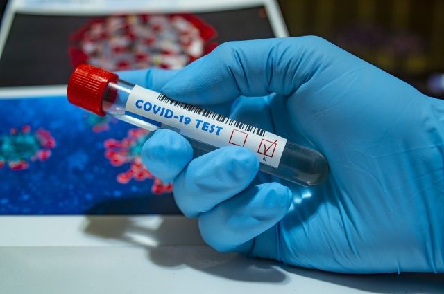 За сутки число заболевших коронавирусом выросло на 41 человек