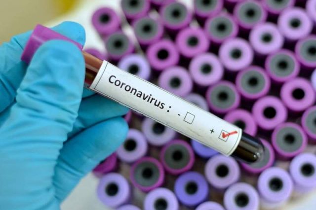 46 новых случаев заболевания COVID-19 выявлено в Дагестане