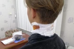 Стрелял по трубе, а ранил подростка: в Херсоне задержали «снайпера»