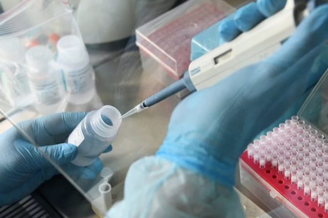 В Краснодарском крае выявлено 98 новых случаев коронавируса 30 июля