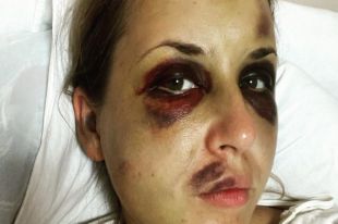 Нападение в поезде «Мариуполь-Киев» привело к активности хейтеров