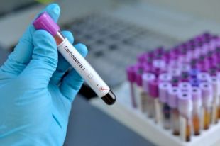 Эксперты признали арбидол препаратом выбора при лечении COVID-19