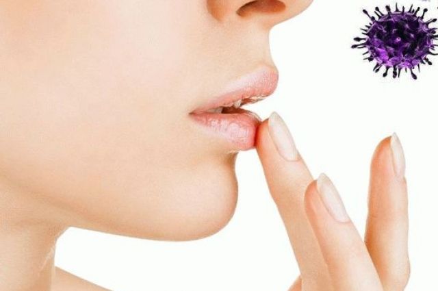 Герпес на губах: причины и способы лечения