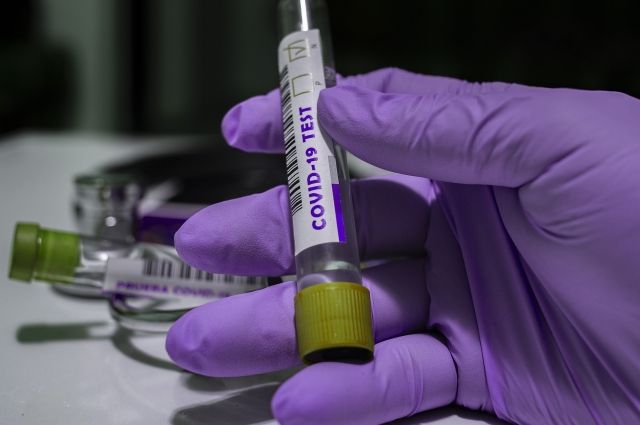 Коронавирусом за сутки в Югре заболел 141 человек