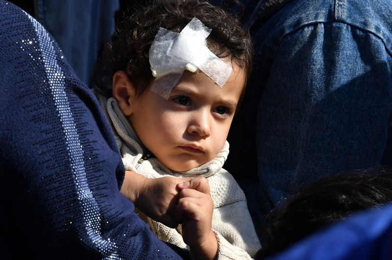 Ребенок, пострадавший в результате обстрела города Гянджа.