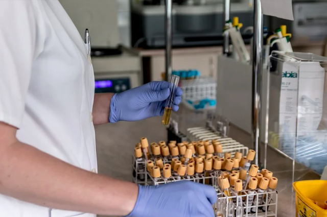 В Приангарье лаборатории не справляются с потоком тестов на коронавирус