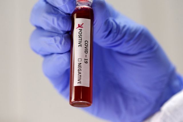 У 177 кузбассовцев диагностировали коронавирусную инфекцию