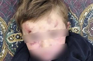 В Тернопольской области отчим избил четырехлетнего мальчика