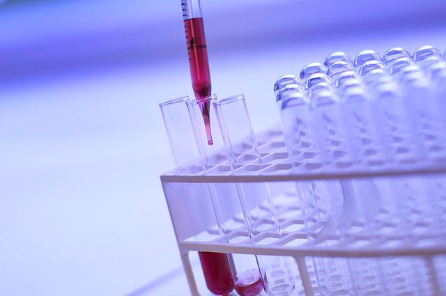Дополнительную лабораторию для диагностики коронавируса откроют в Братске