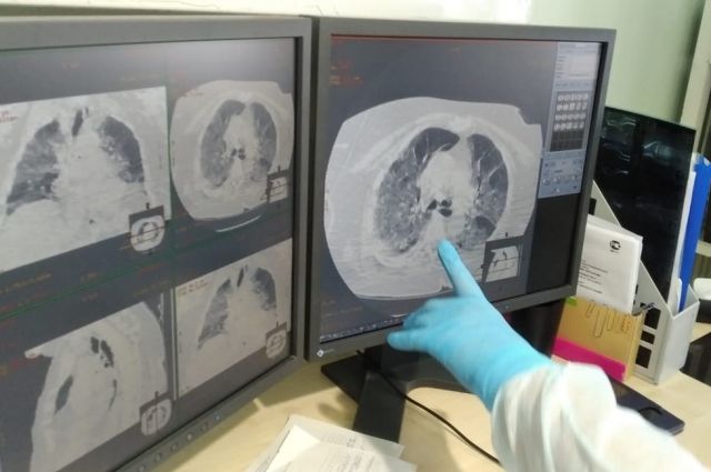 В Псковской областной клинической больнице выявили новый очаг коронавируса