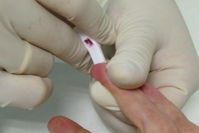 Заболеваемость ВИЧ-инфекцией снизилась в Челябинской области
