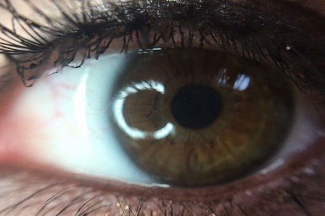 Цвет Глаз Человека Фото