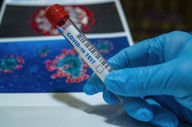 В Орловской области выявили 176 новых случаев коронавируса