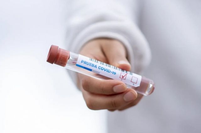 В целом в Прикамье за сутки зафиксирован 281 случай заражения коронавирусом.