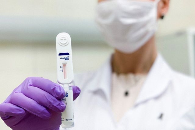 На Кубани возобновили бесплатное экспресс-тестирование на ВИЧ