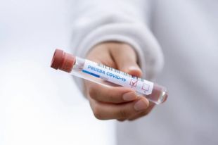 За все время пандемии коронавирус унес жизни 609 жителей области.